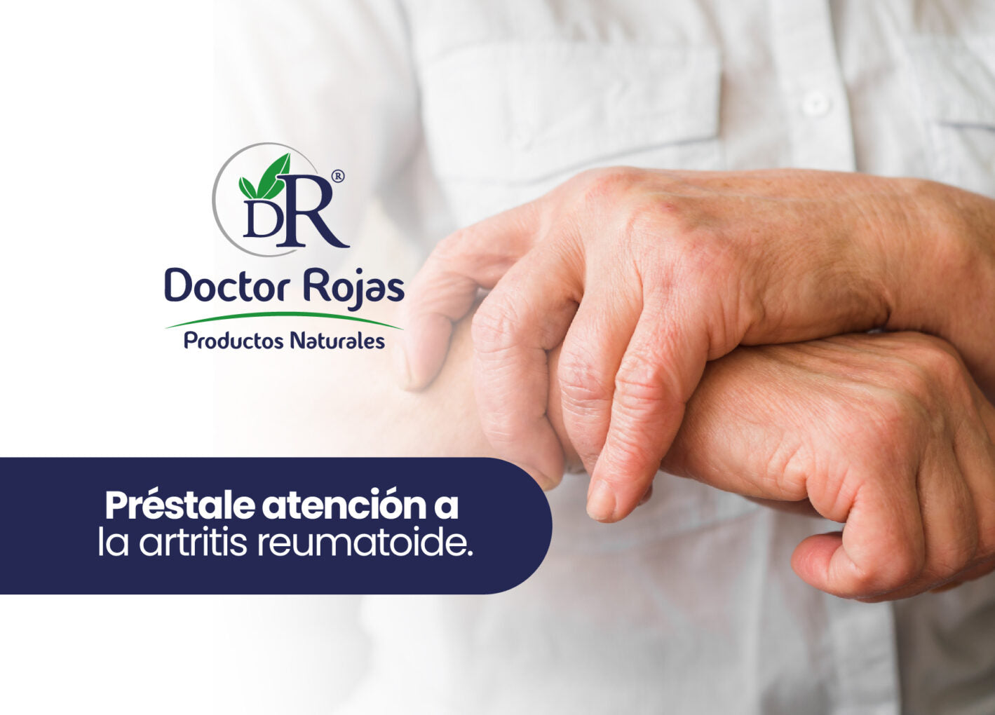 Préstale atención a la artritis reumatoide