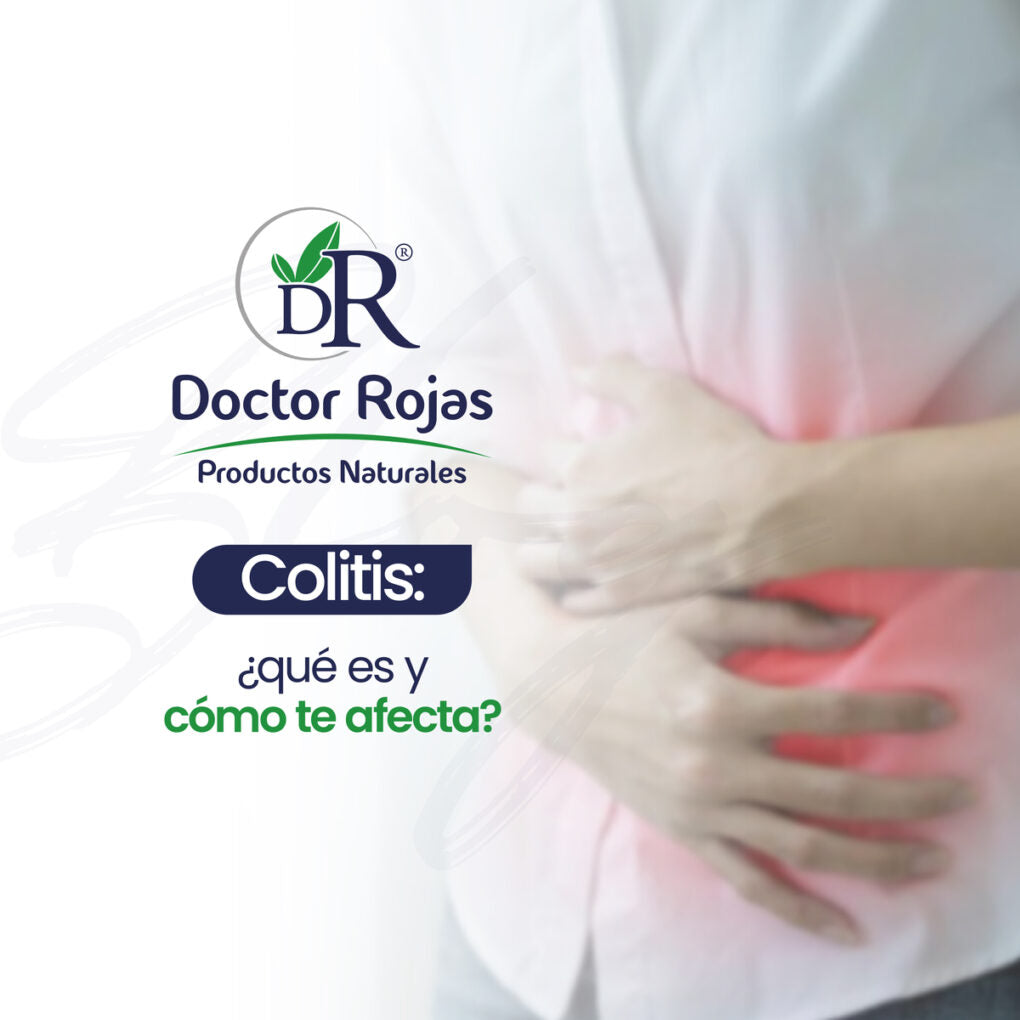 Colitis: ¿qué es y cómo te afecta?