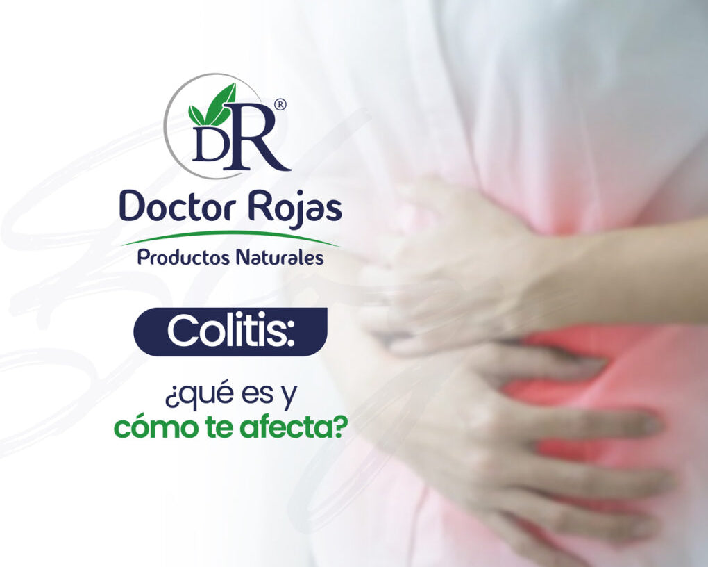 Colitis: ¿qué es y cómo te afecta?