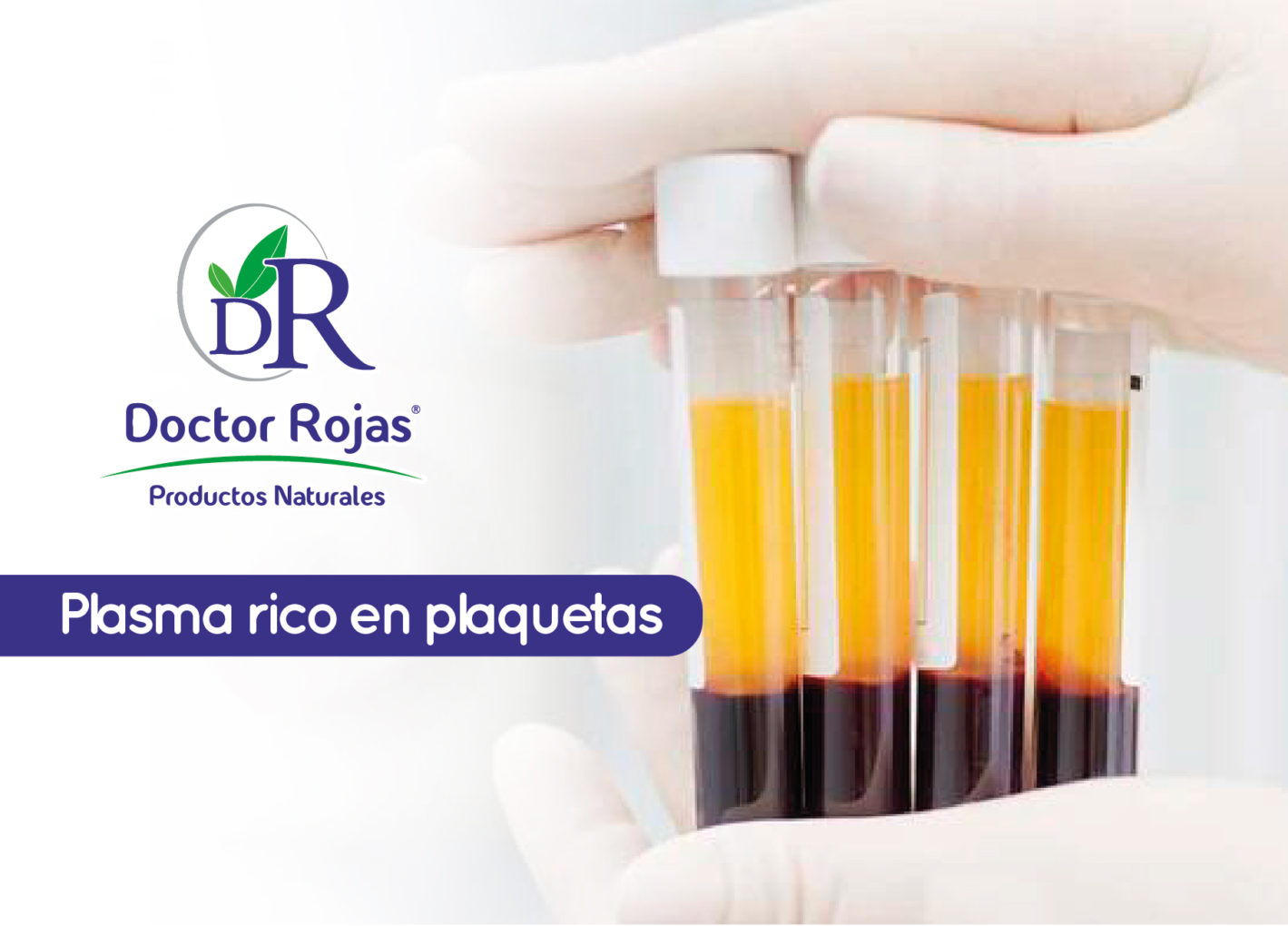 Plasma rico en plaquetas