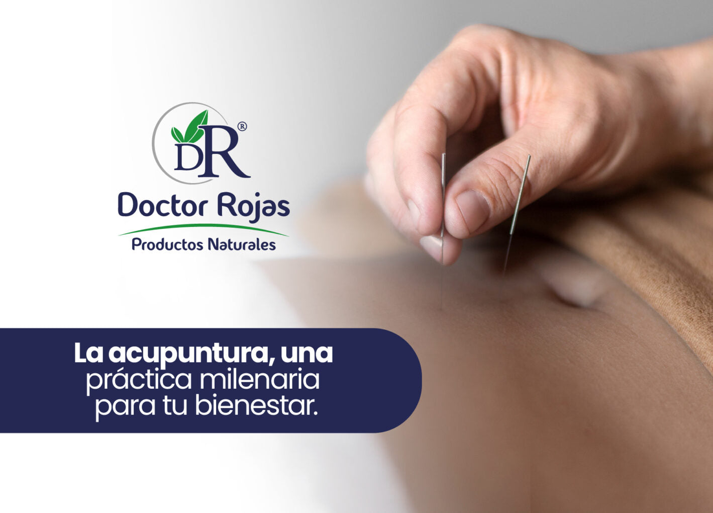 La acupuntura, una práctica milenaria para tu bienestar